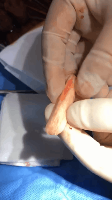 下图是取出的膨体,我们可以看到很完整,形态并未发生变化.