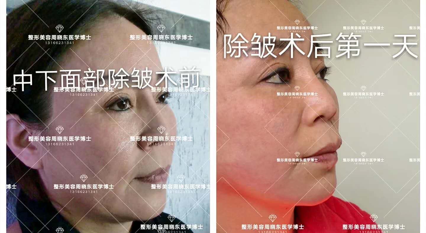 上海周晓东博士整形外科专家