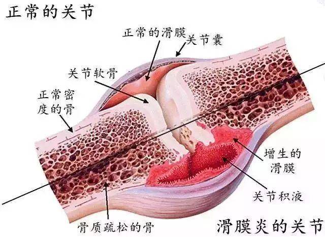 膝关节解剖图详解图片