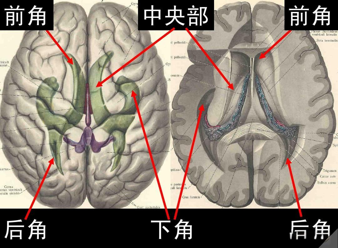 脑室,脑膜,脑池的详细解剖学图集