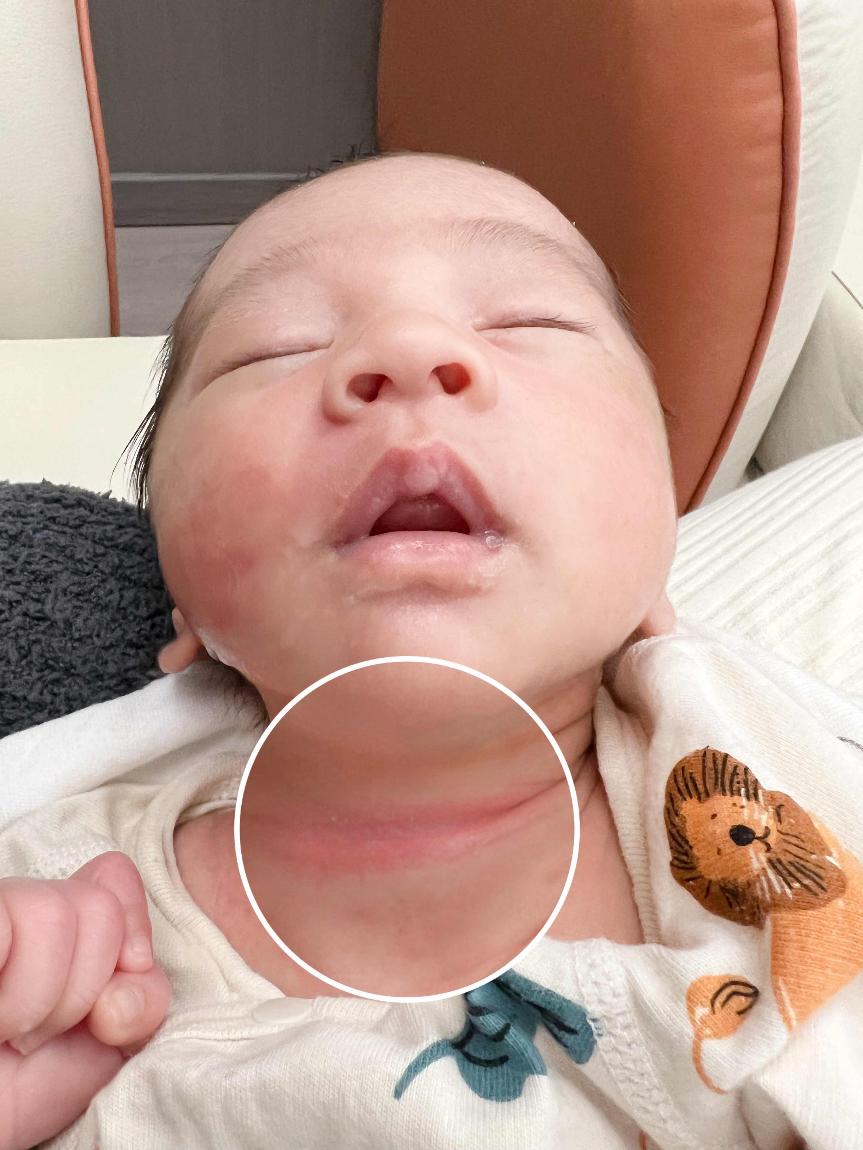 拯救腌脖子的小妙招非常简单