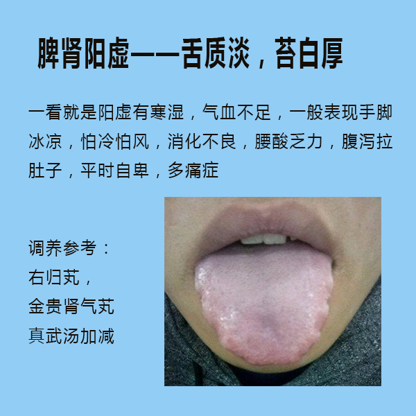 脾虚湿重,阴虚内热和脾肾阳虚的舌苔是什么样的?
