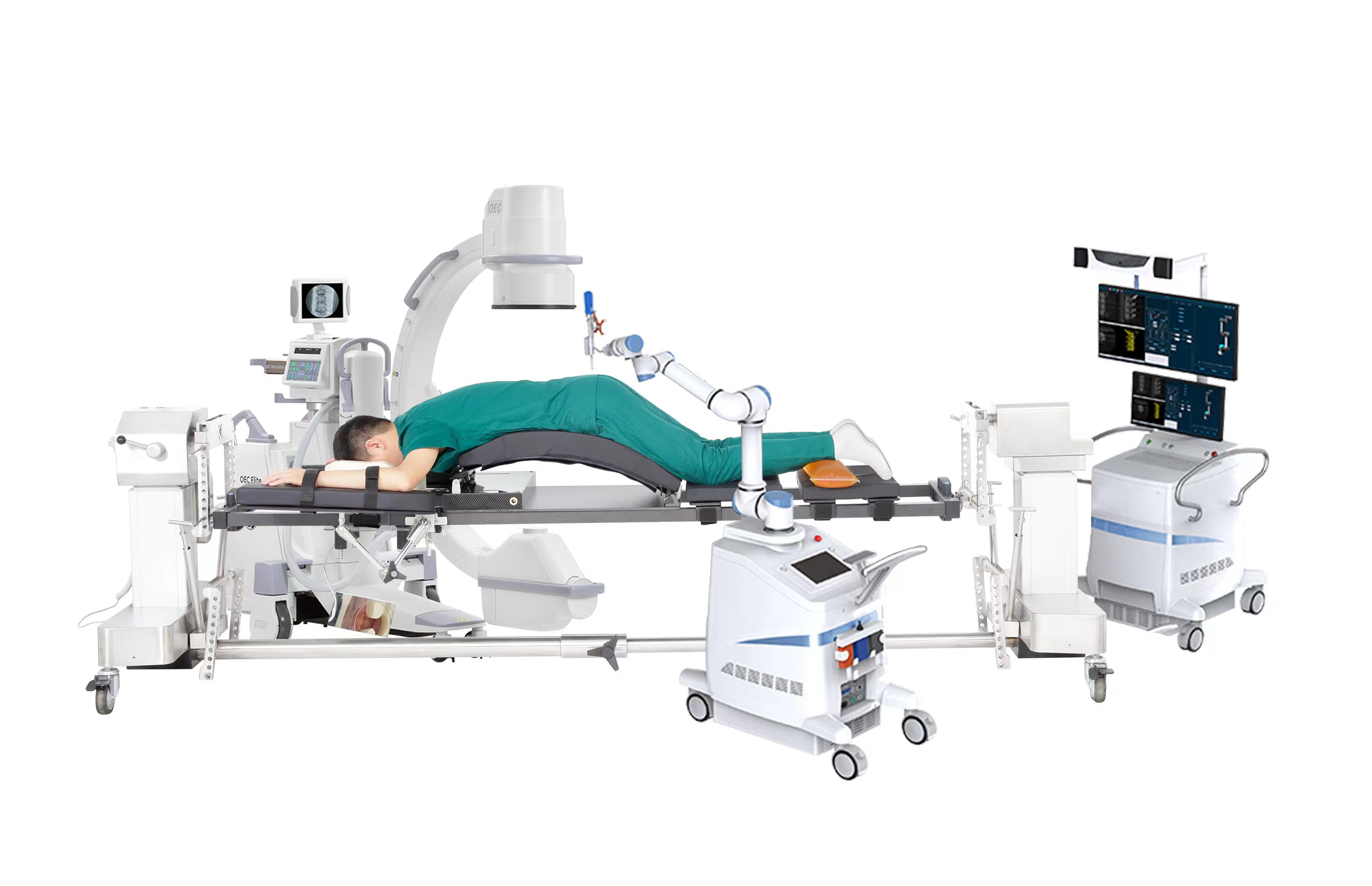 c型臂手术床 骨科手术床