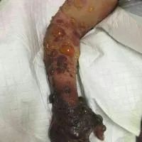 新冠未平,炭疽又来!