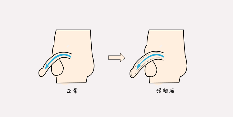 丁丁怎么变粗变大图片