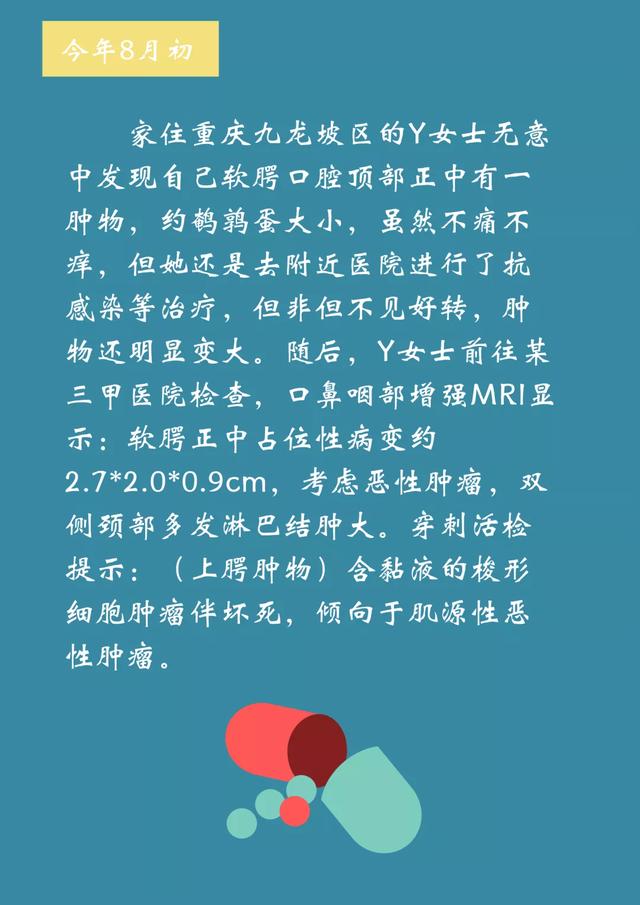 软腭癌图片