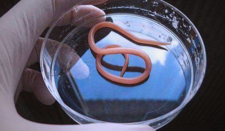 蛔虫为何从生活中的常见寄生虫逐渐消失?