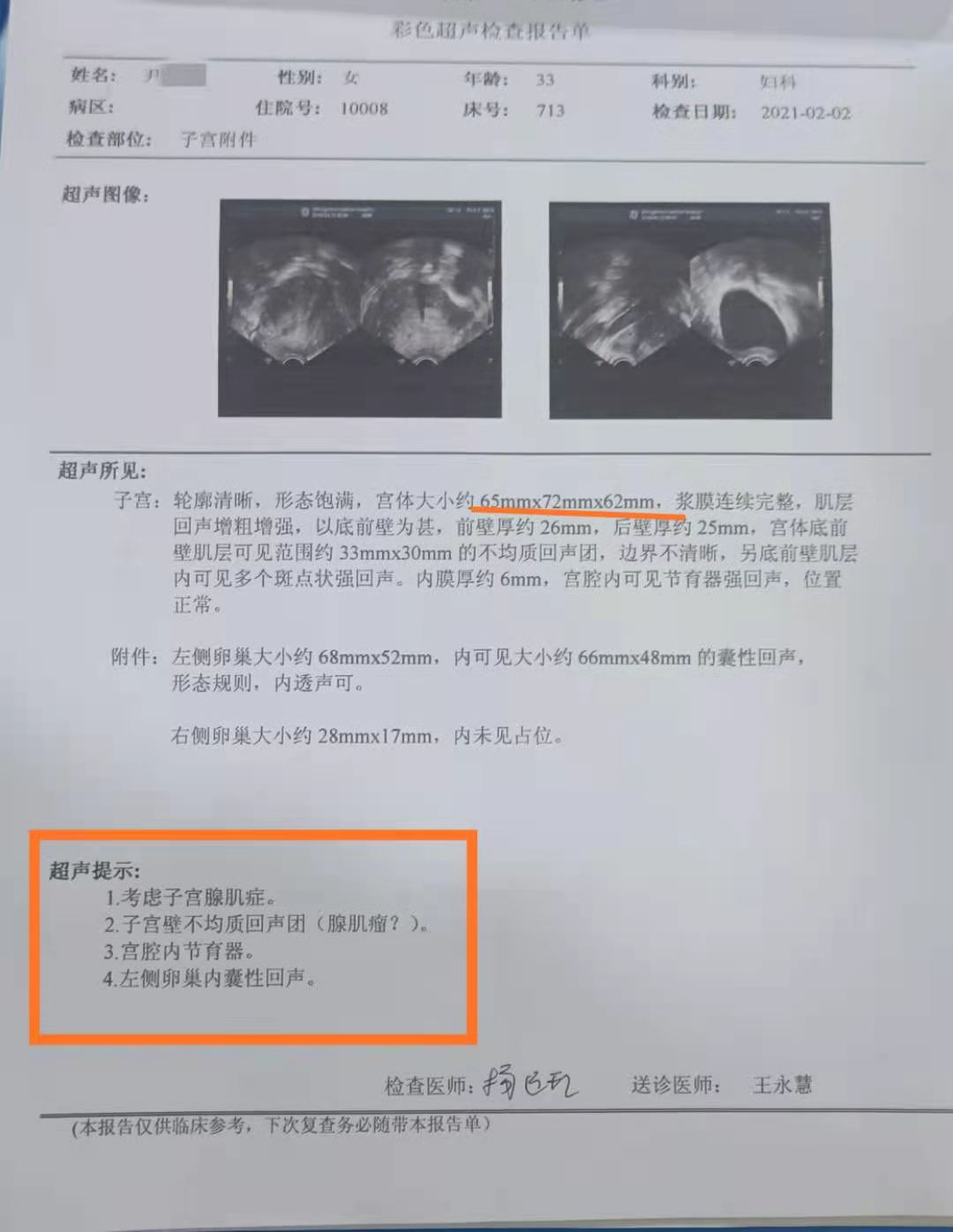 曼月乐环放置时间图片