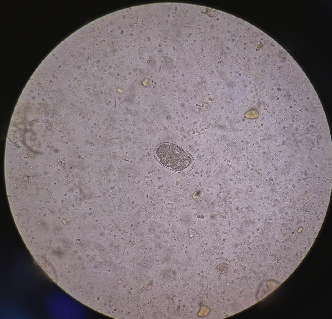 显示,钩虫卵的大小约为(56～76)μm×