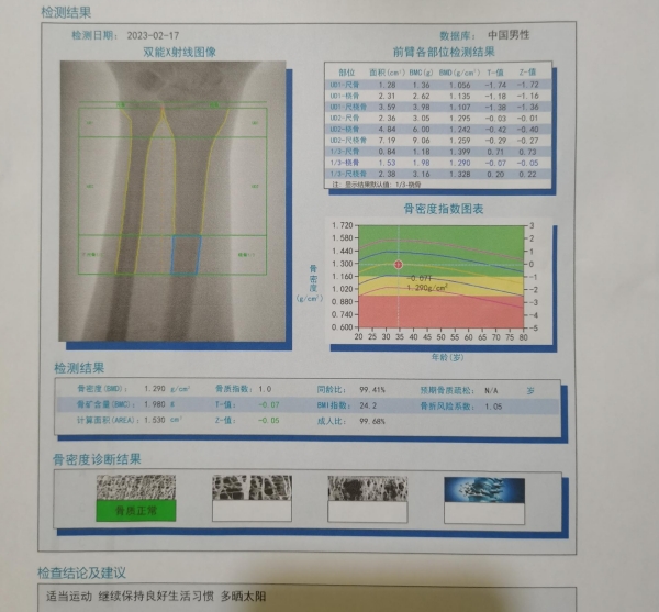 淺析超聲骨密度儀與雙能x線骨密度儀的區別