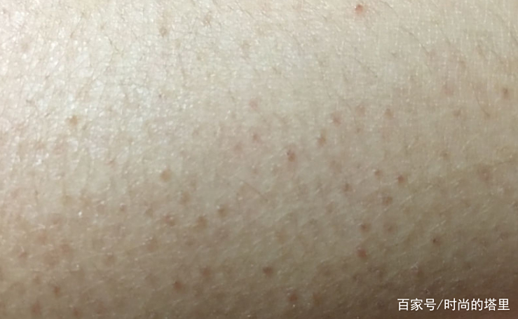 鸡皮肤会致癌吗(鸡皮肤对人体有害吗)