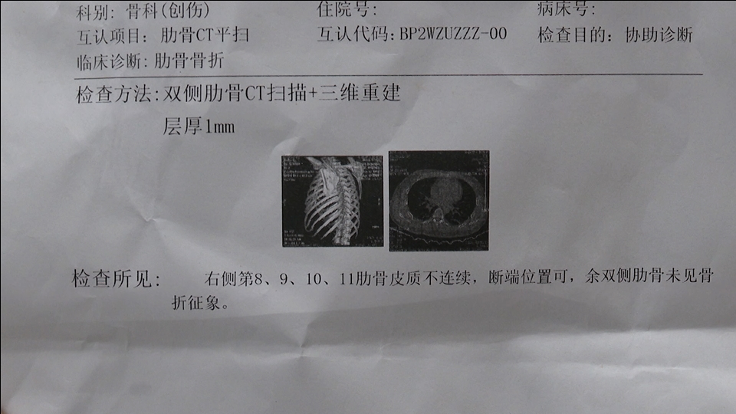 肋骨骨裂诊断书图片