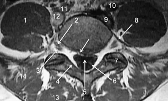 胸,腰椎mr解剖