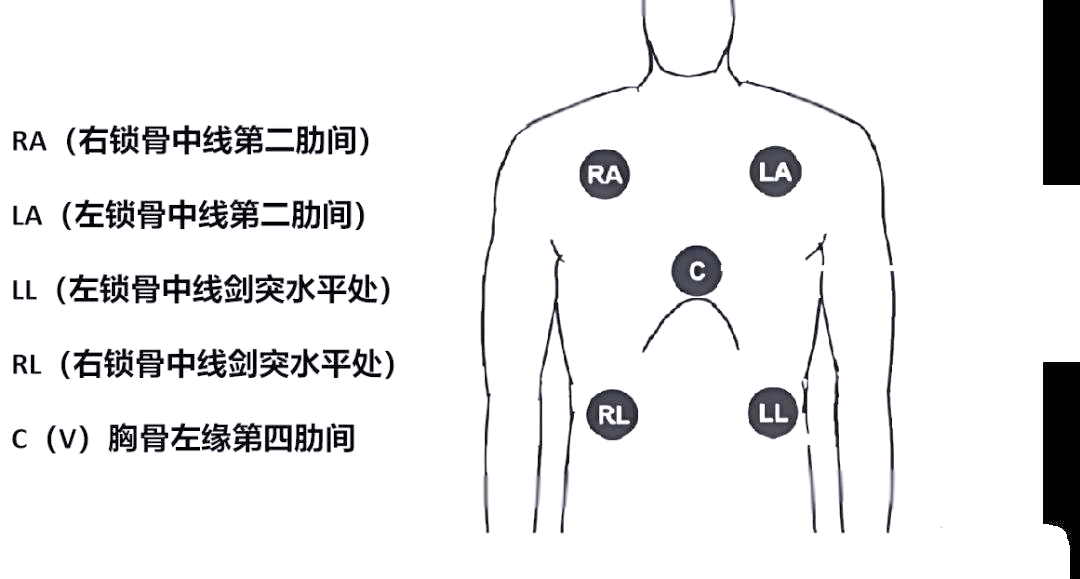 正确贴放电极,确保位置准确