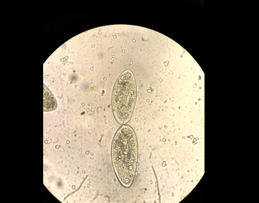 探索微观世界:草履虫的生命之旅