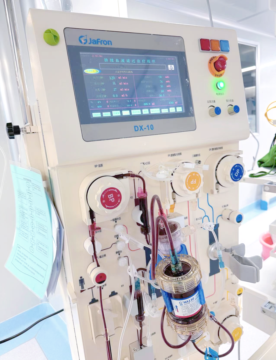 重症医学科运用血液灌流技术成功救治多例危重患者