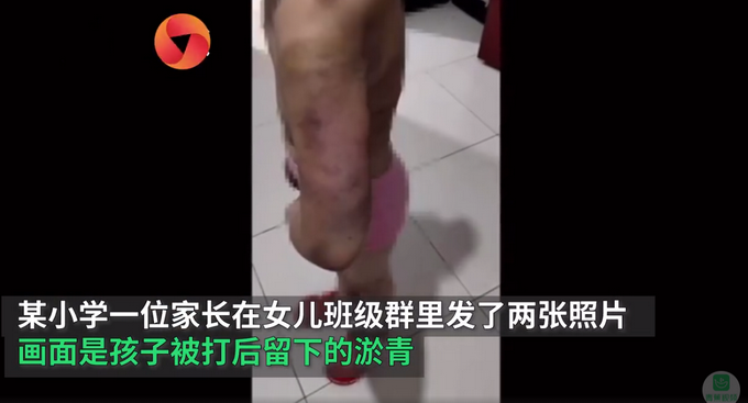 江苏小学生未完成作业被老师用水管抽打,校方:涉事老师已停职