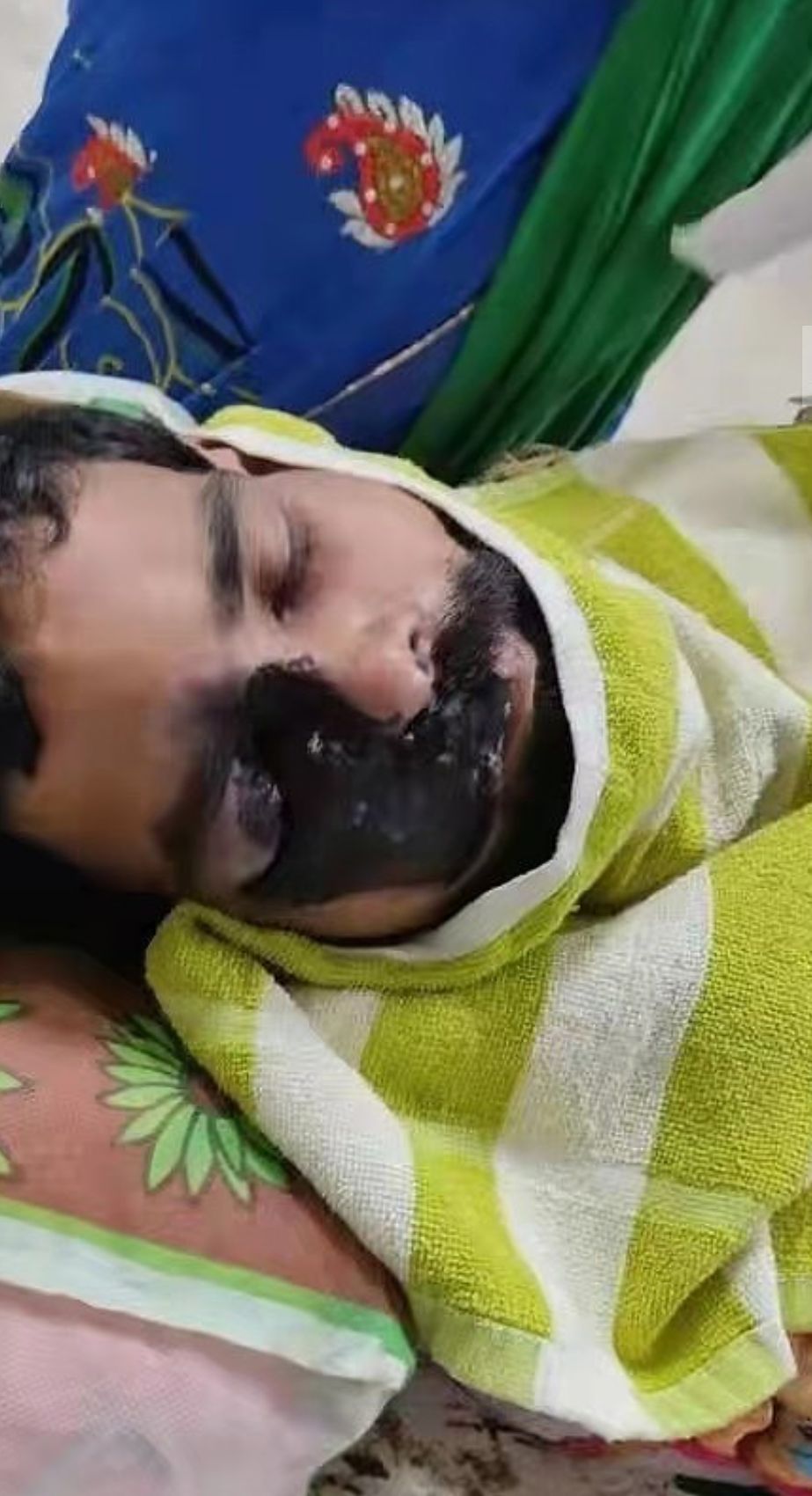 印度"活人发霉",现实版的生化危机上演