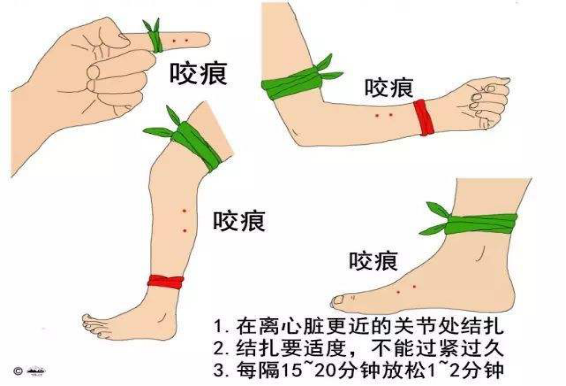 芝罘区的于先生就被毒蛇咬了一口
