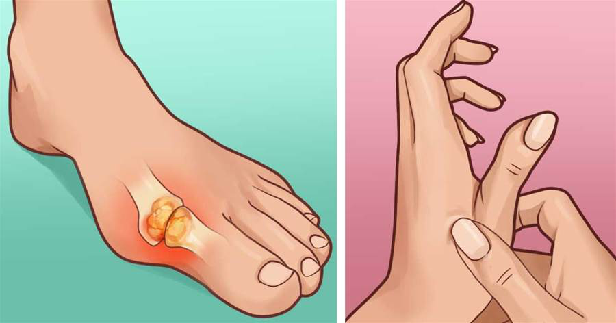 痛风发作痛不欲生!樱桃,苹果醋有功效!8招家庭疗法!