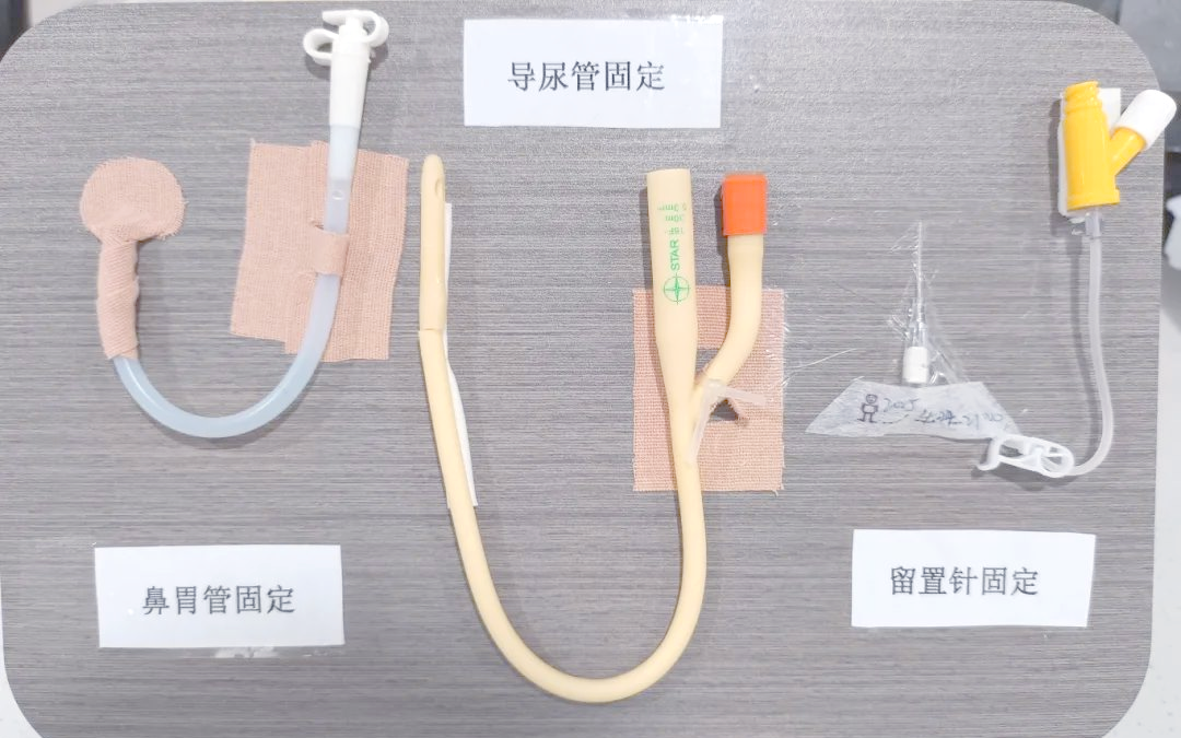 绩溪县人民医院通过创新培训提升导管固定安全水平