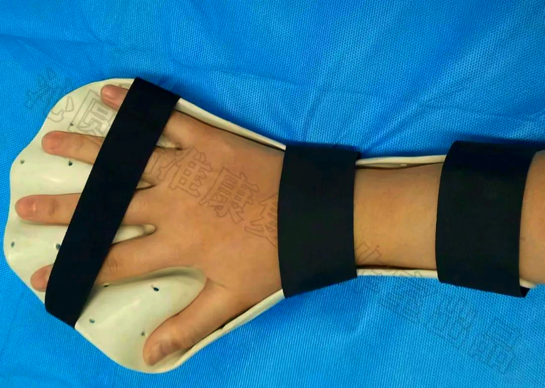 康复科普:矫形器助力肌张力恢复