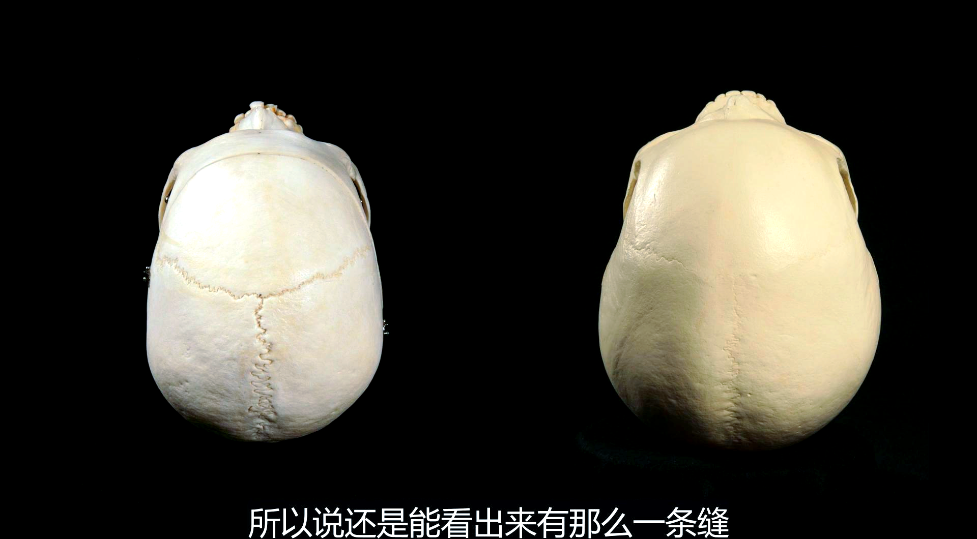 帕拉卡斯头骨:挑战人类认知的神秘遗骸