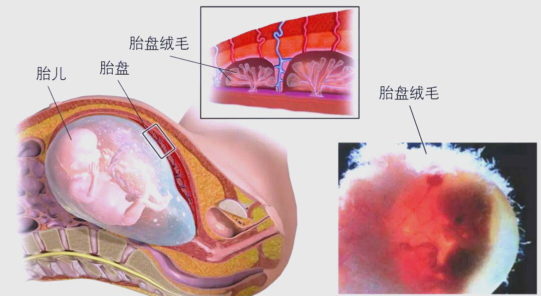 胎盘:胎儿成长的关键支持与营养桥梁