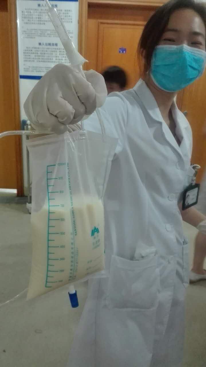 牛奶状淋巴液渗透胸,腹腔!忽视身上一个小疙瘩的她患上这个病