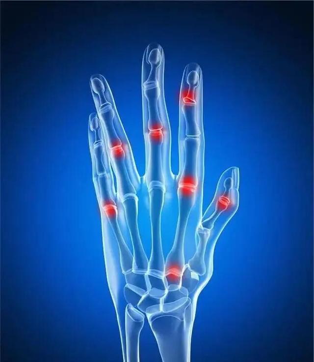 手指关节疼痛是怎么回事?