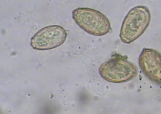 肝吸虫卵显微镜图片图片