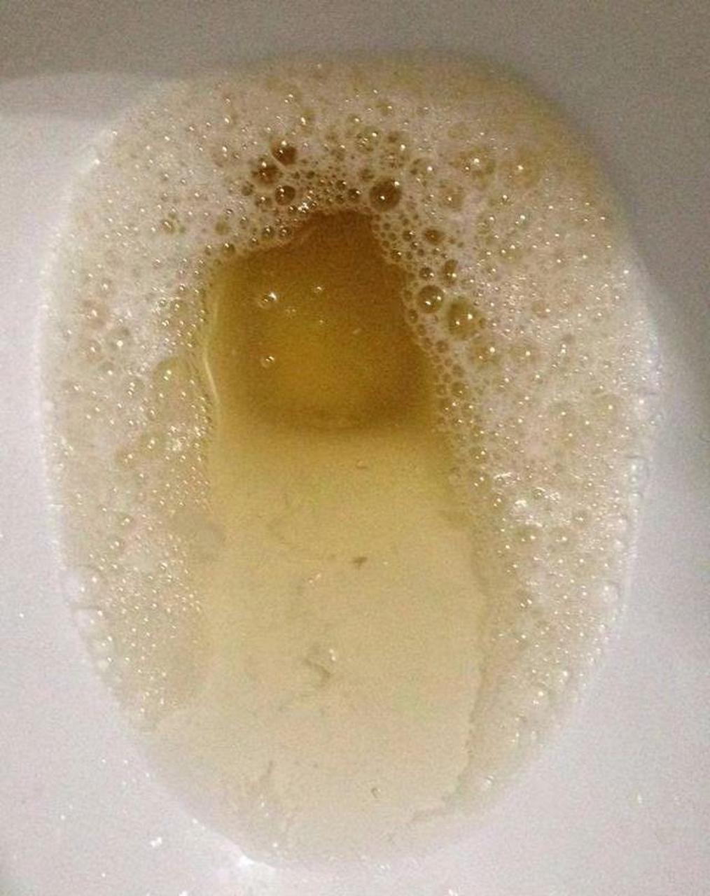 ③我今天的尿有股特殊臭味,是不是肾不行了等等.