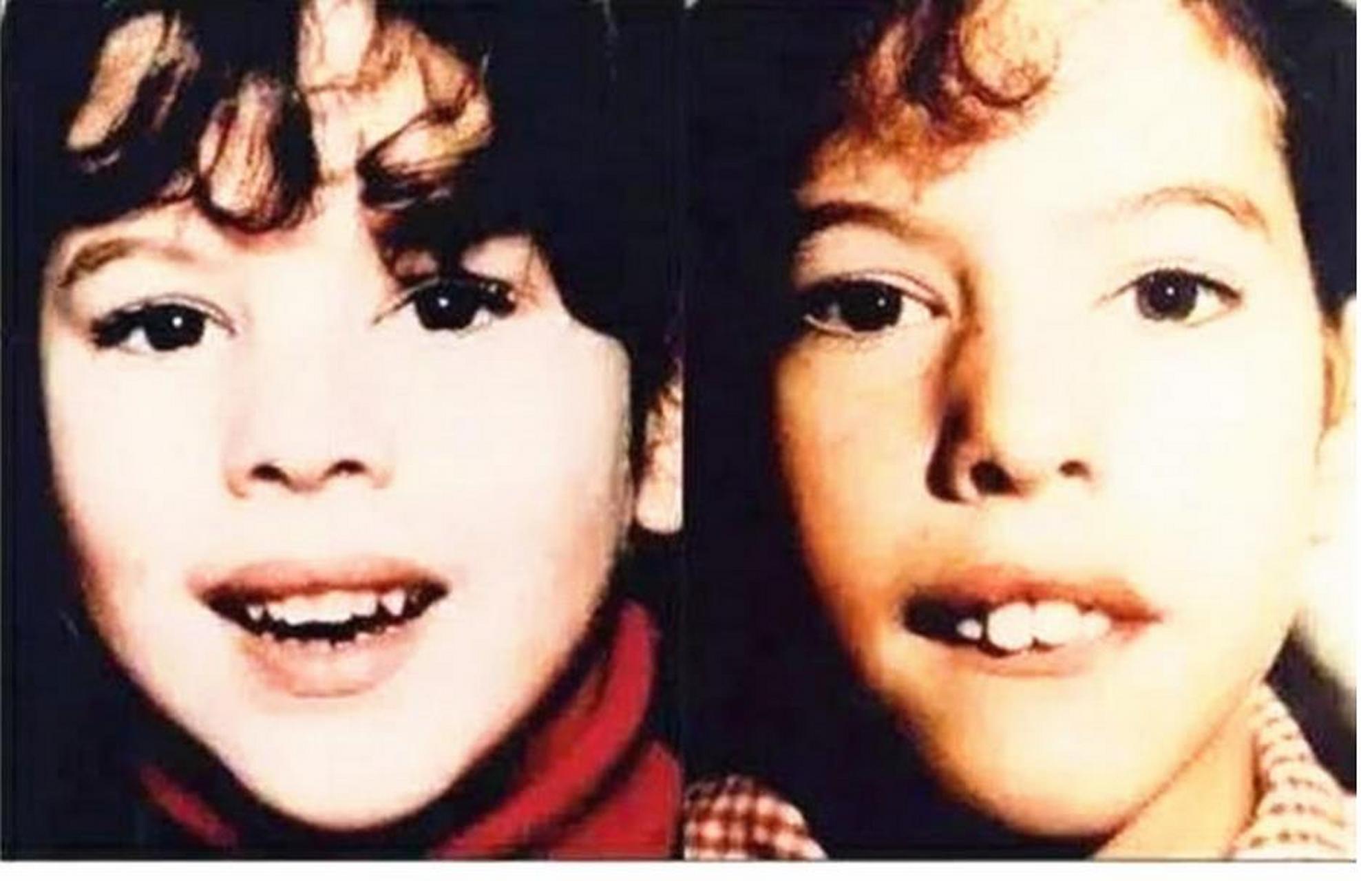 腺样体面容#  怀疑腺样体肥大,担心要做手术怎么办?