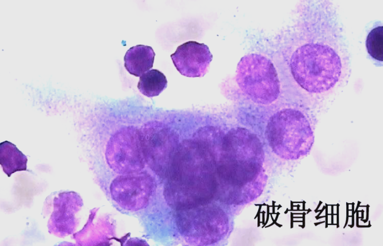 成骨细胞与破骨细胞:骨骼健康的守护者