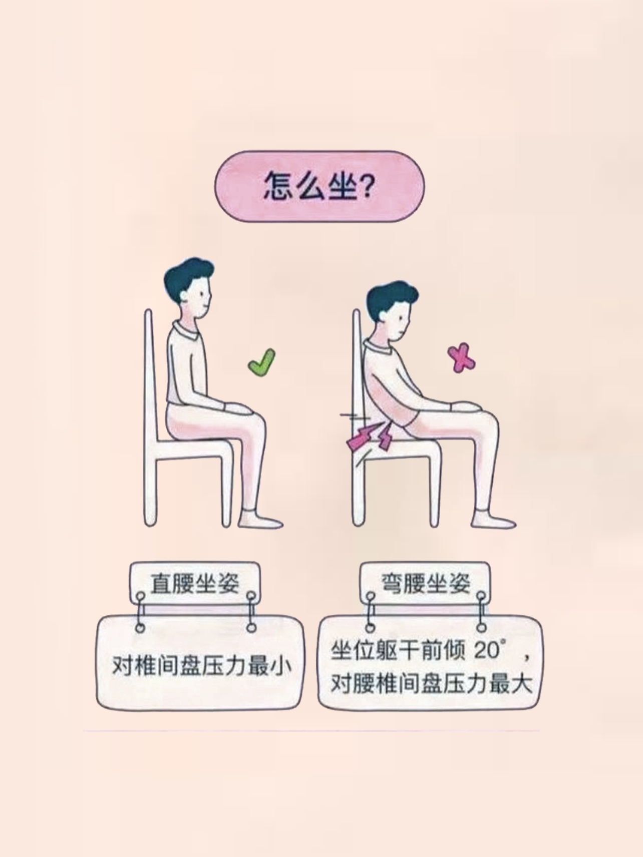 腰椎间盘突出的知识科普