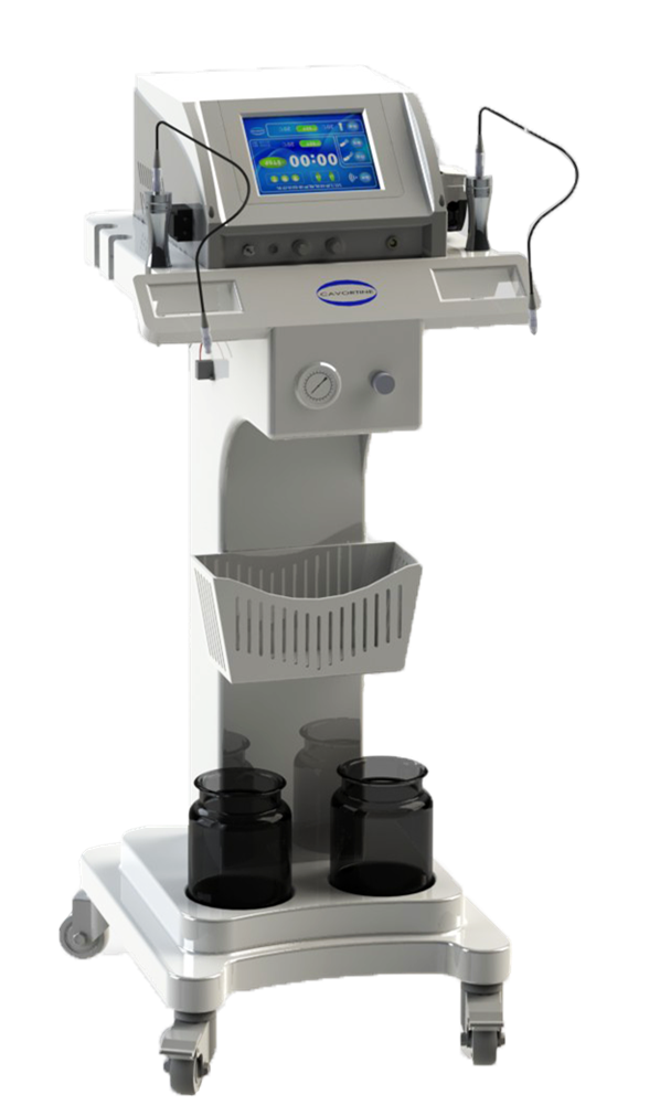 多功能超声清创机慢创领域应用