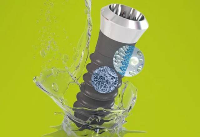 iti瑞锆种植体为什么会受到青睐?