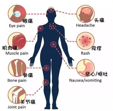 多国正处在登革热疫情的上升阶段游玩出入境需要做好预防