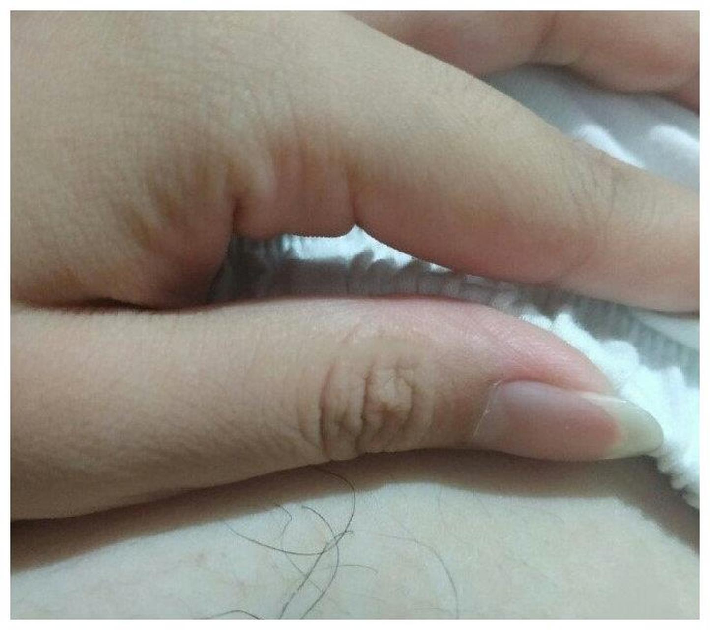 网友投稿:想问一下女生肚子上长毛怎么办,好丢人啊,怎么才能去掉呢