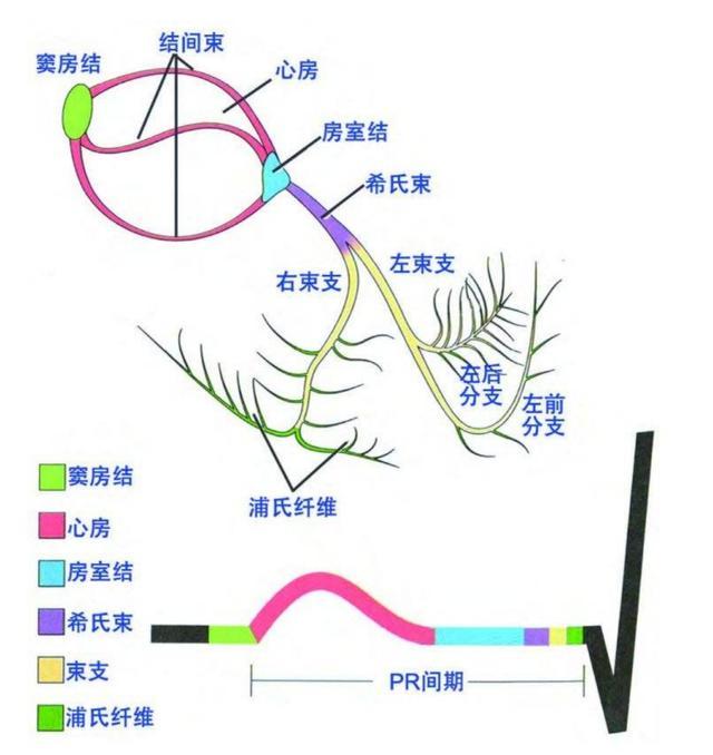 窦性心律不齐图解图片