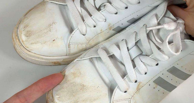 白布鞋发黄了怎样变白