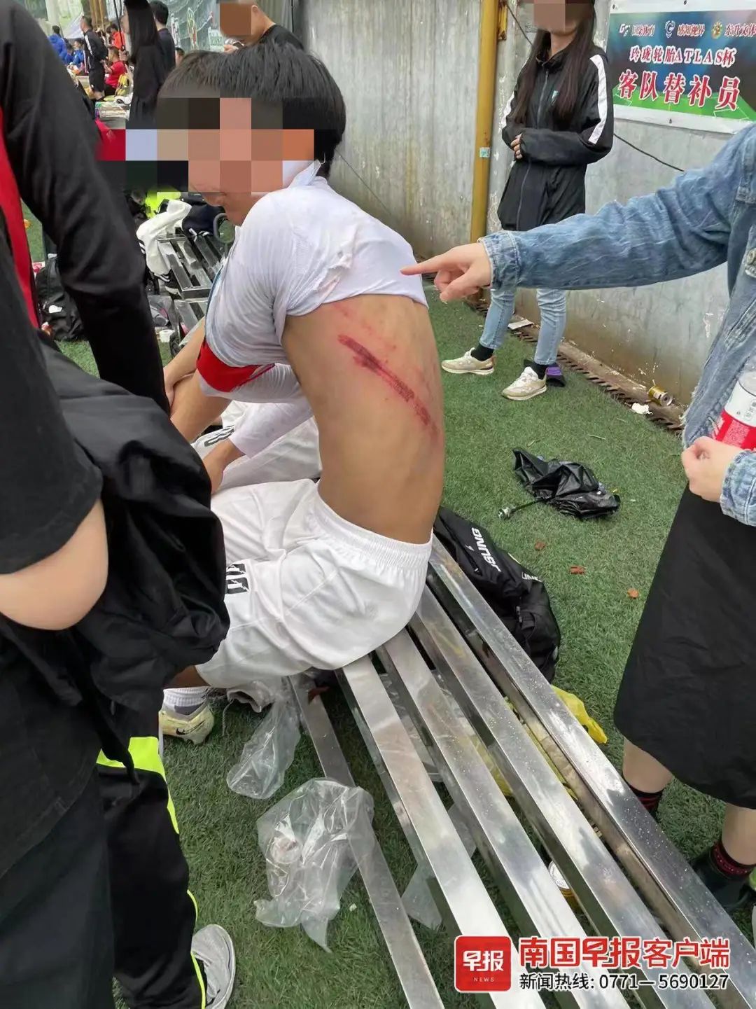 柳州这场足球赛引发冲突,多人受伤!最新回应