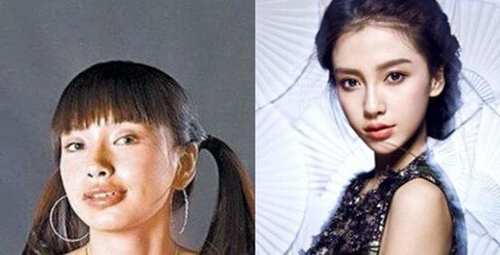 欧美女明星整容前后,好莱坞女星最爱增厚上嘴唇,没整的时候是真女神