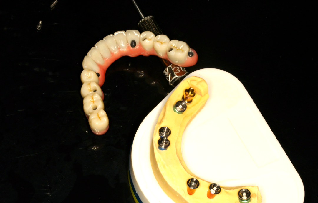 马龙桥使用反馈:从咀嚼到心理的全面体验