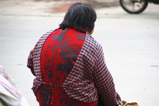 为何年纪不大,老年斑不少?