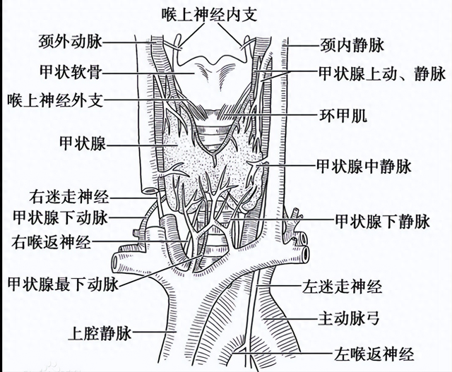 甲状腺癌淋巴结疑似转至肺部致癌,精准诊断原发微浸润可控可根治