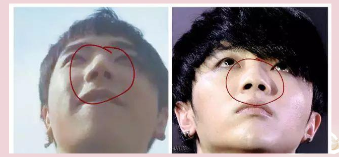 华晨宇整容前后对比引发网友热议