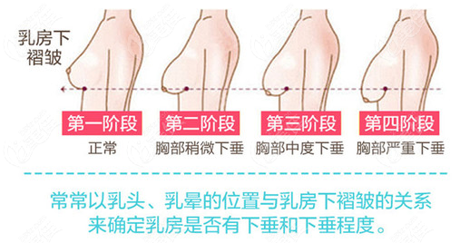 乳房正常起来部位图片