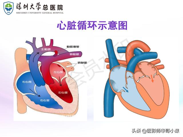 左心房la 肺静脉ctpv成像技术以及后处理技术