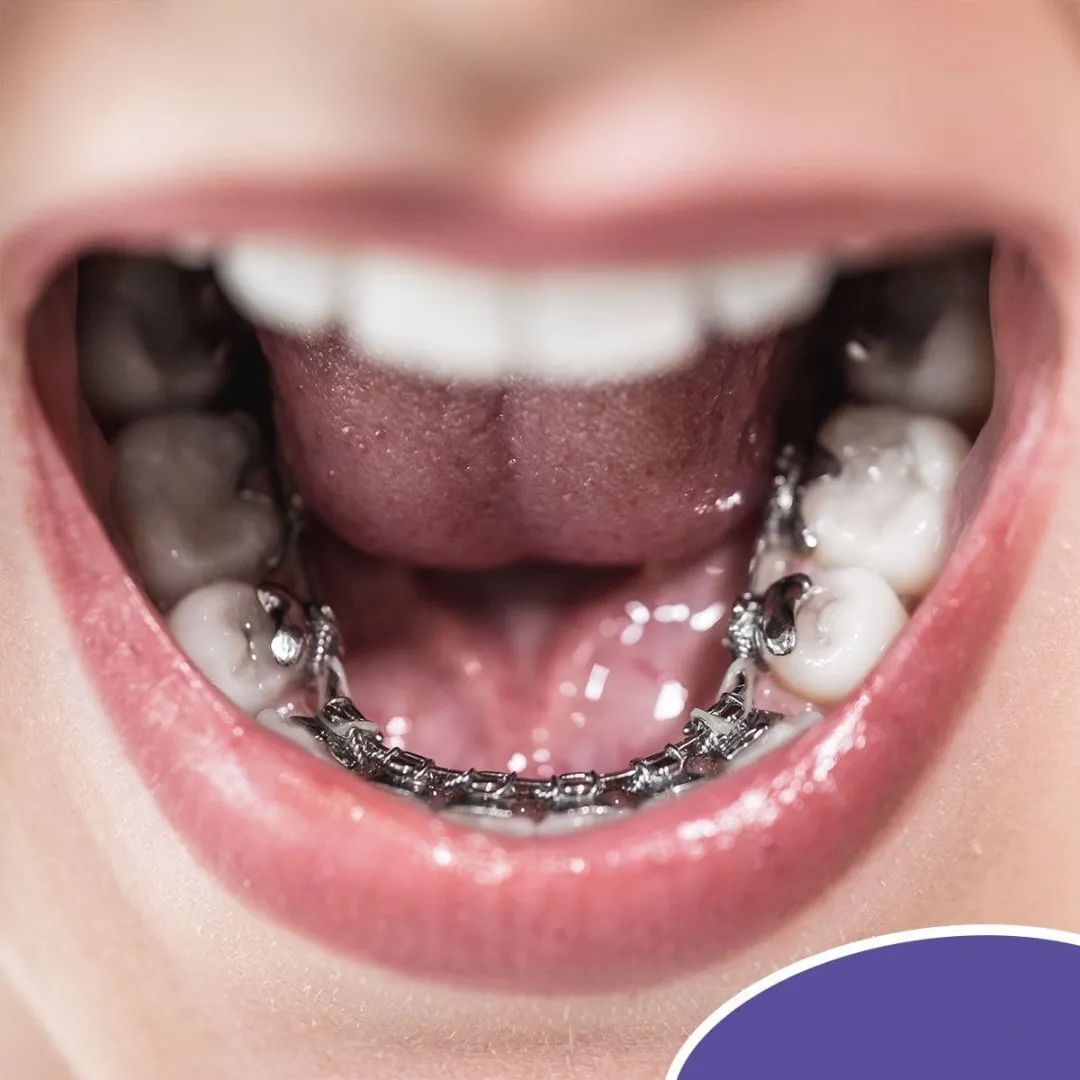 沈刚正畸系列培训-个性化舌侧高端培训班4月11-13日,相约上海!